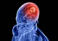 Explorando el Parkinson: Retos y Vivencias en el Día Mundial de Concienciación